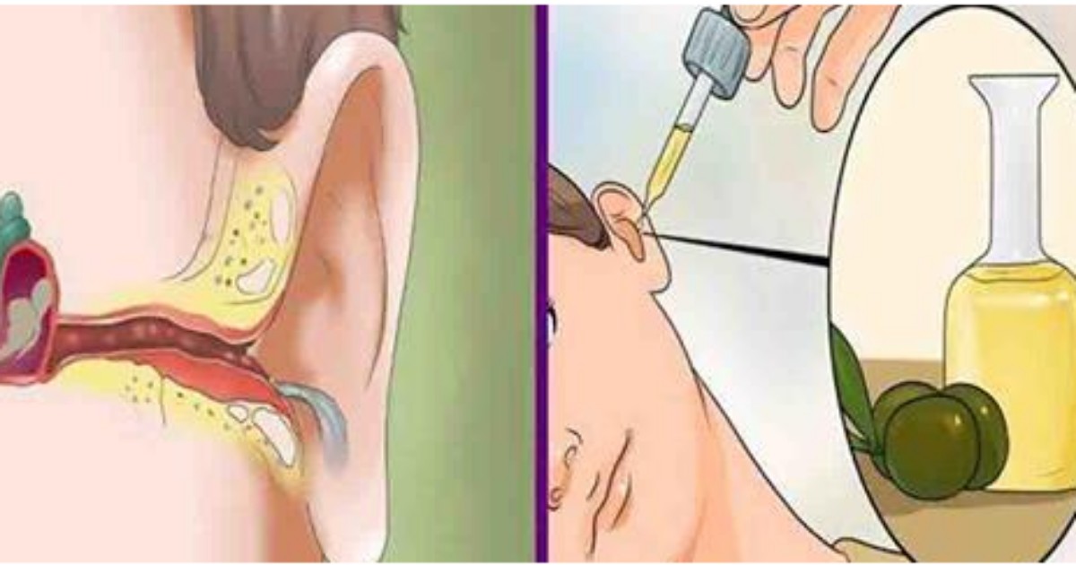 Барабанная перепонка отит. Заложило ухо при насморке. Оглохло ухо при простуде. Тубоотит барабанная перепонка. Заложило уши при простуде.
